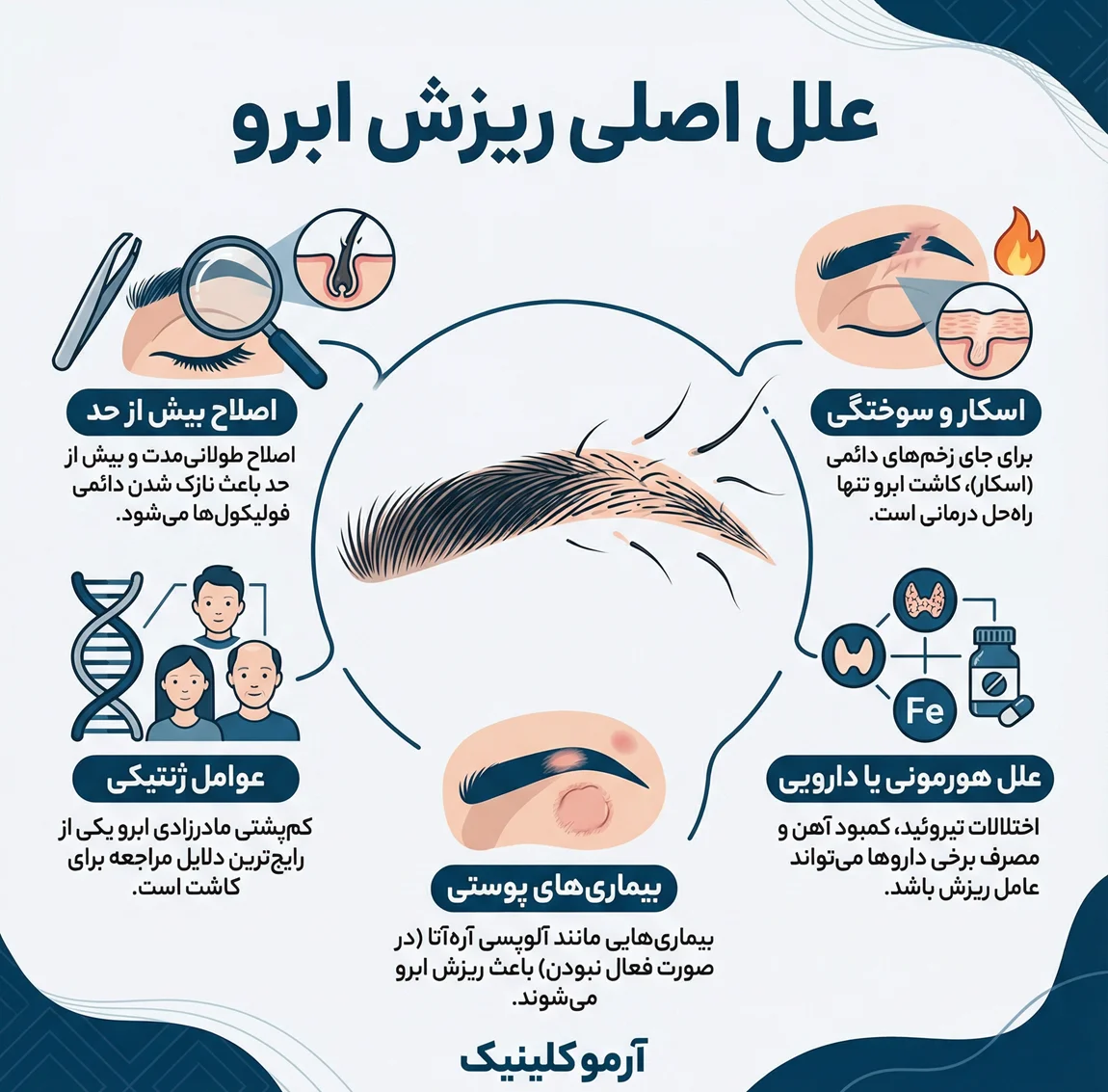 اینفوگرافیک علل اصلی ریزش مو