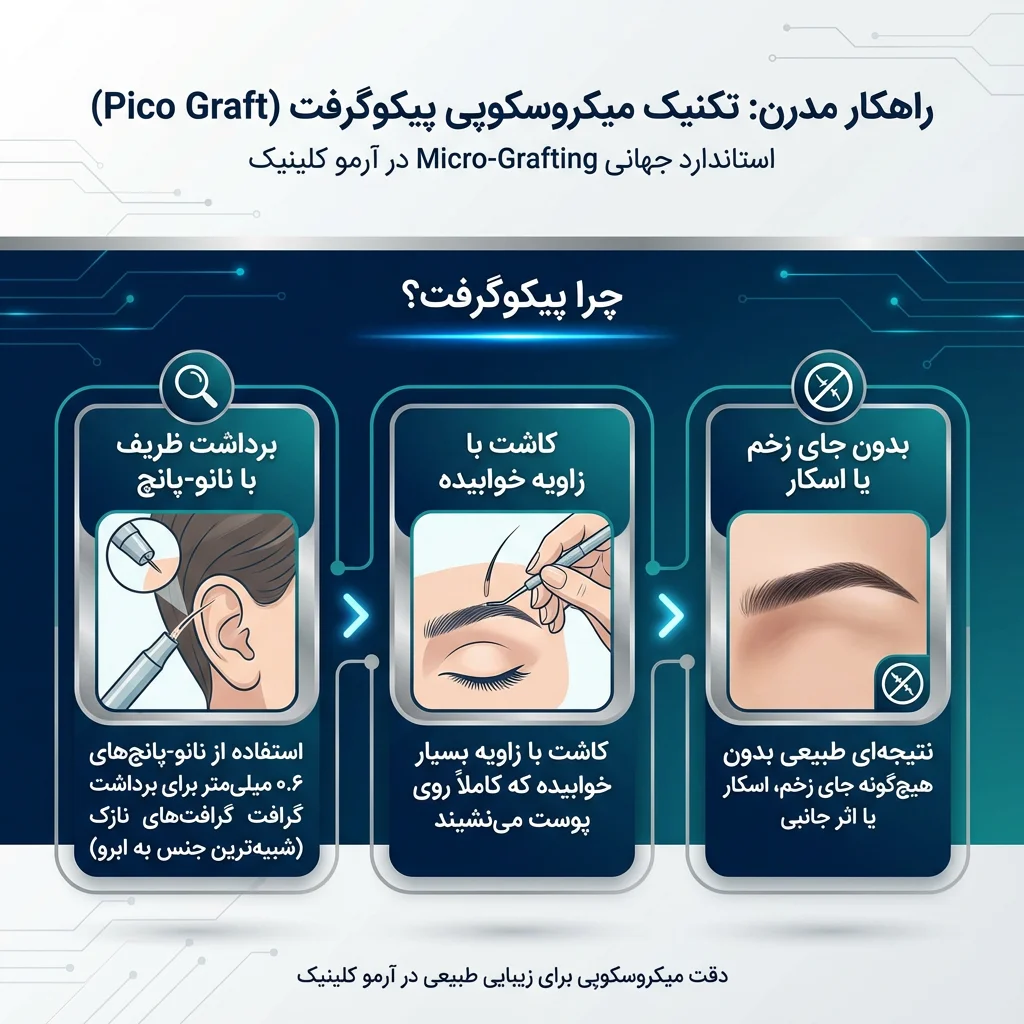 اینفوگرافیک روش پیکو گرفت