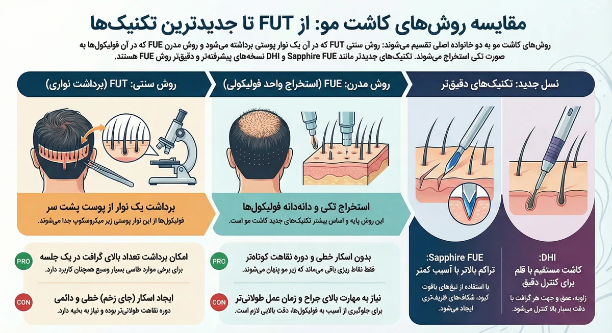 اینفوگرافیک مقایسه روش های کاشت مو