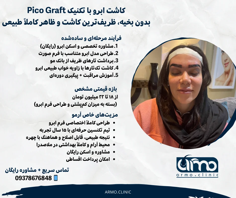 کاشت ابرو 1 بهترین دکتر کاشت ابرو در قزوین