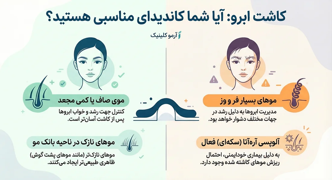اینفوگرافیک کاندید مناسب کاشت ابرو