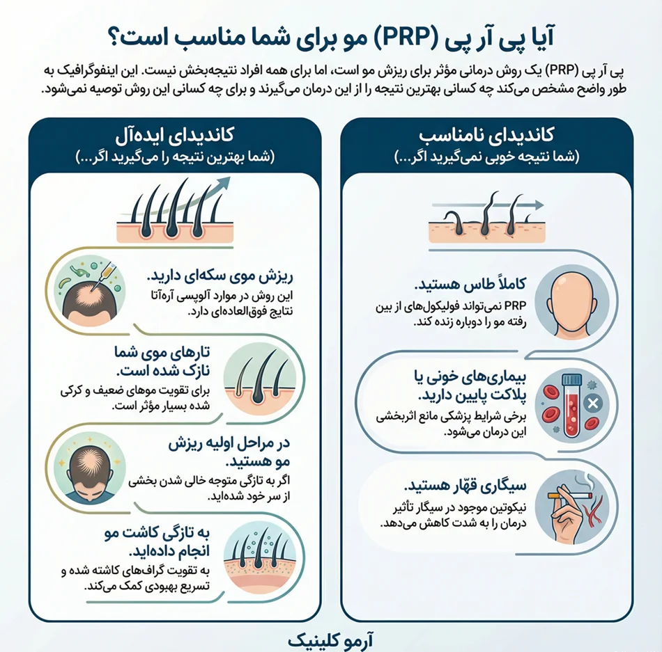 پی ار پی مو 2 اینفوگرافیک ایا پی ار پی برای شما مناسب است