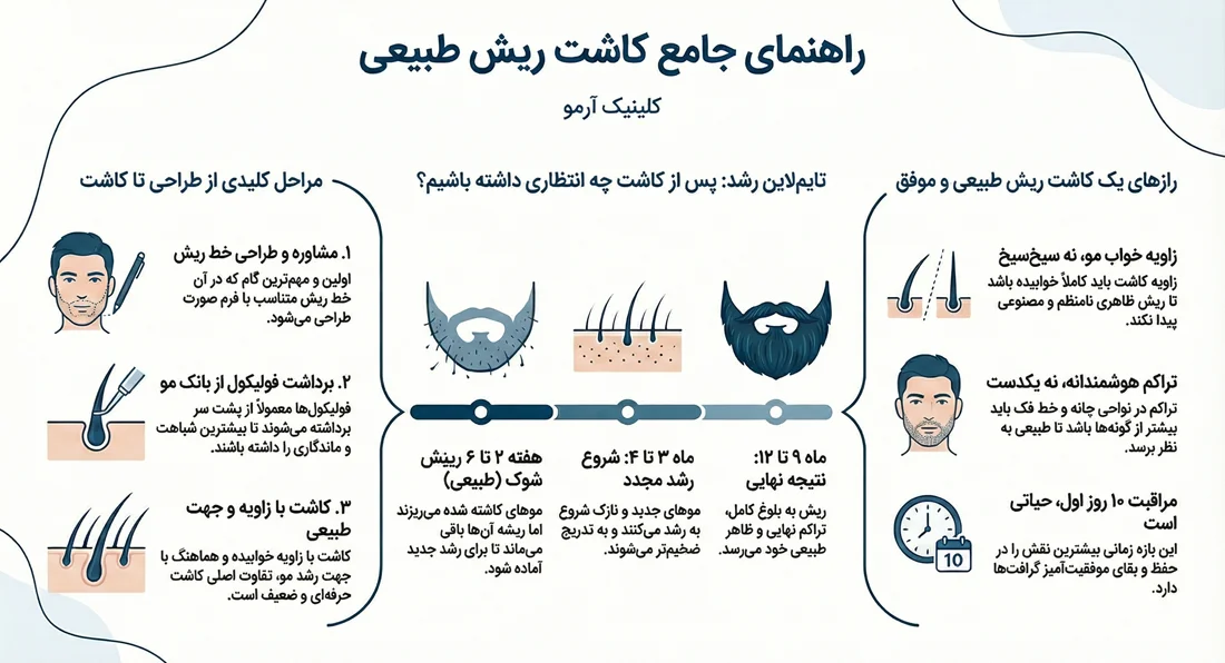 اینفوگرافیک کاشت ریش چگونه انجام می شود