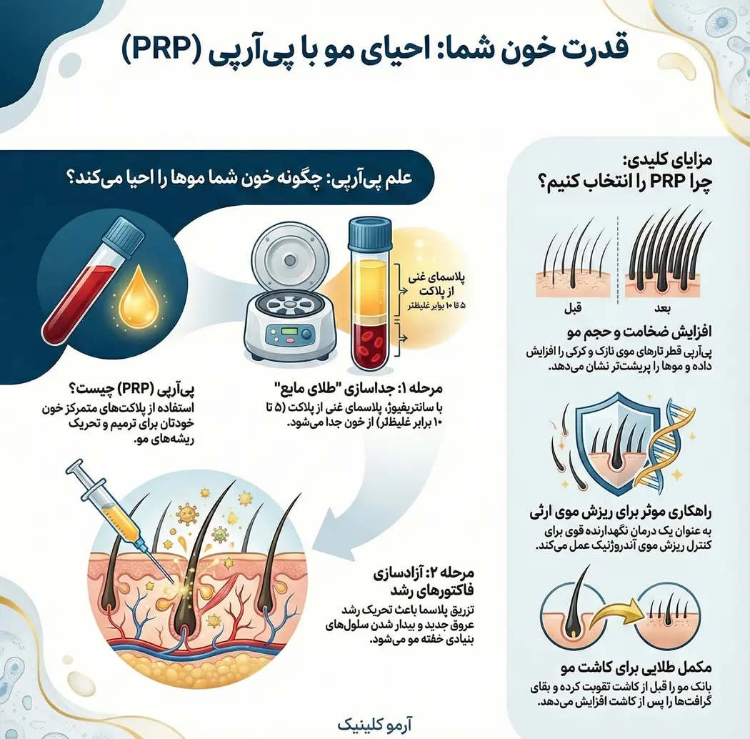 اینفوگرافیک مزایای پی آر پی مو