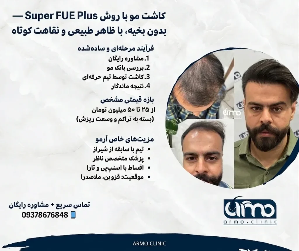 هزینه کاشت مو برای موهای کم پشت