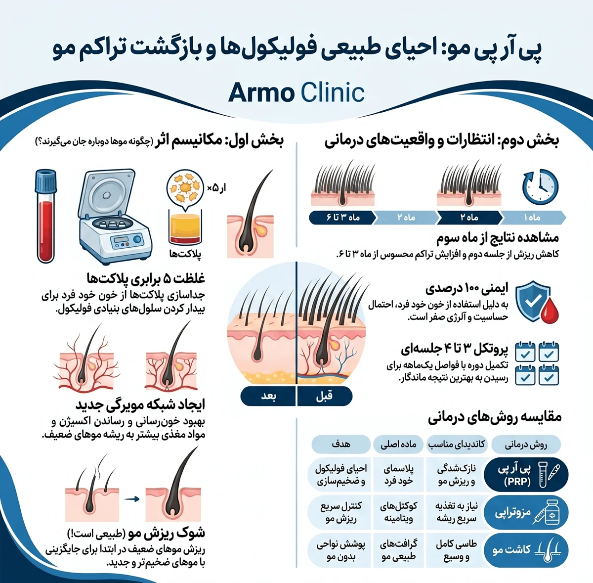 اینفوگرافیک ایا پی ار پی باعث رویش مجدد مو می شود