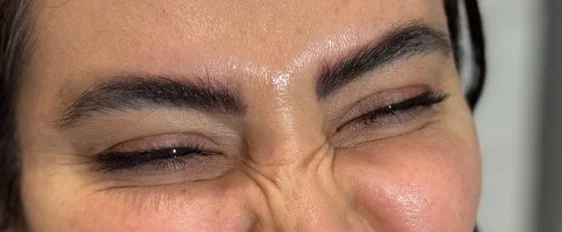 بهترین کلینیک بوتاکس در قزوین