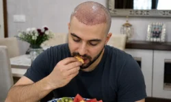 یک مرد جوان با ظاهر ایرانی/خاورمیانه‌ای که به‌تازگی کاشت مو انجام داده است.