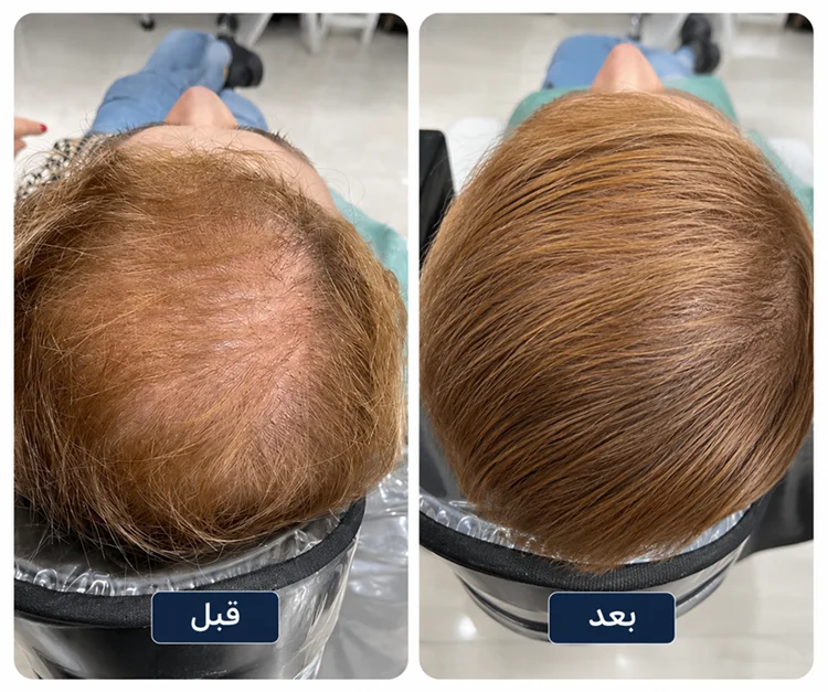 نمونه کار پی آر پی مو - نتیجه ۳