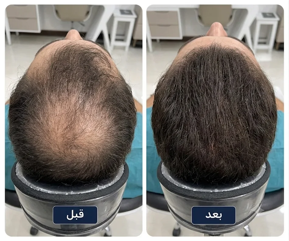 نمونه کار پی آر پی مو - نتیجه ۲