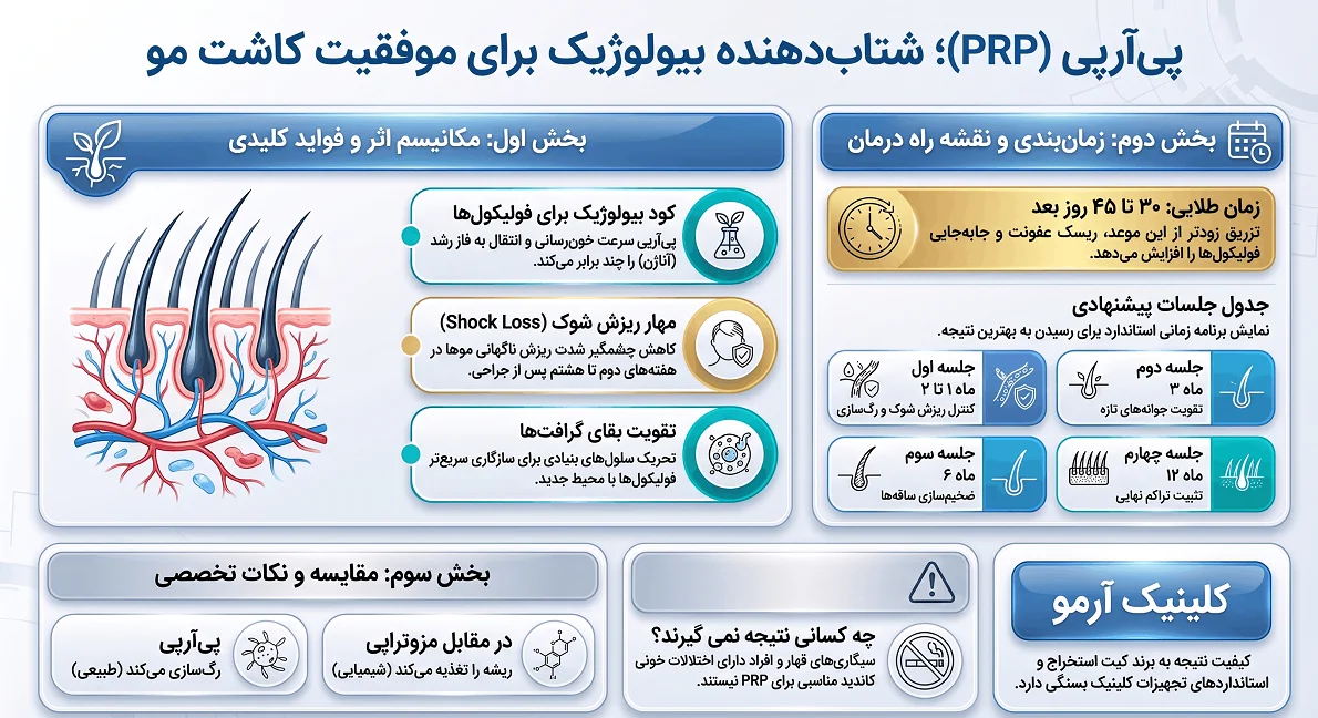 اینفوگرافیک پی ار پی بعد از کاشت مو 