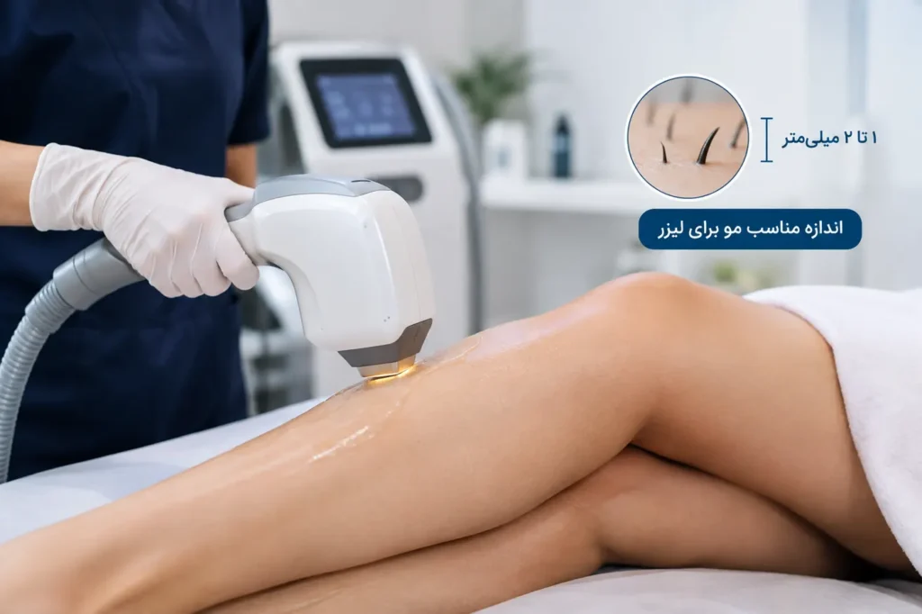 اندازه مو قبل از لیزر موهای زائد و نحوه صحیح شیو قبل از جلسه