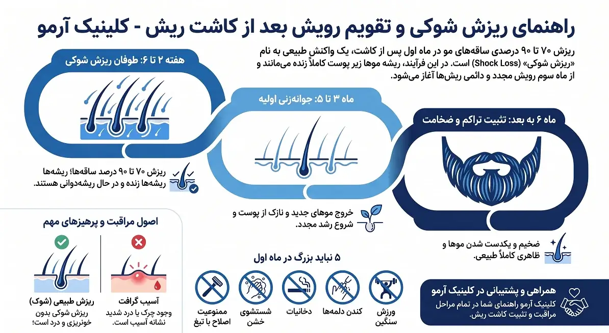 اینفوگرافیک راهنمای ریزش شوکی بعد از کاشت ریش 